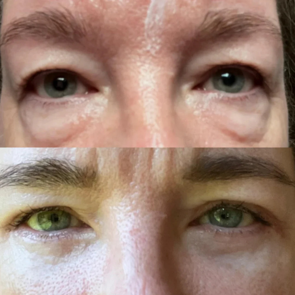 Eye Mask with Bio-Collagen, Peptide Complex & Vitamin C